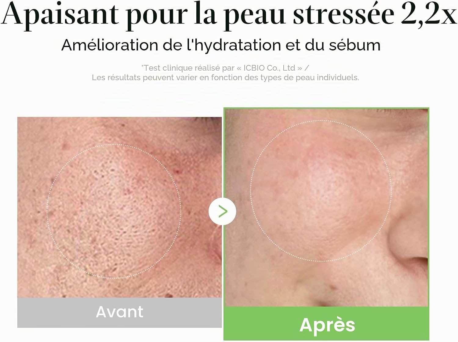 Infographie montrant les résultats avant après sur l'atténuation des rougeurs et la réparation cutanée avec le soin Medicube.